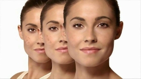 روش‌های سریع درمان جوش‌های صورت 