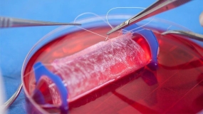استفاده از شبکه سلولز برگ اسفناج در مهندسی بافت و تولید بافت زنده قلب انسان