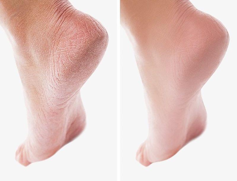 راهکارهای طبیعی زیباتر شدن