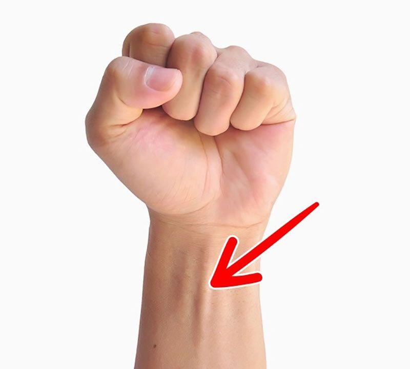 ماهیچه‌ی پالماریس