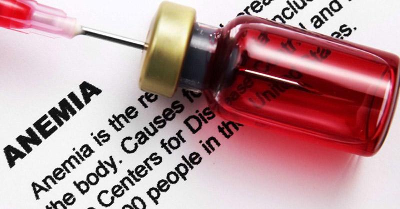 نقش کمبود آهن در آنمی-724press.com