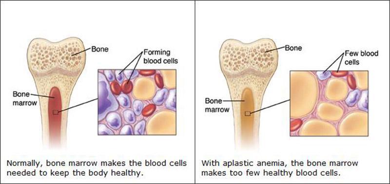 مغز استخوان-724press.com