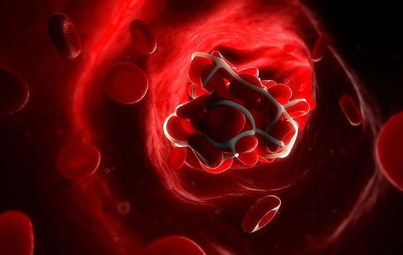 لخته خون-724press.com