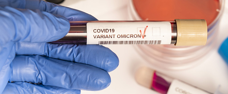 آزمایش خون برای کرونا- 724press.com