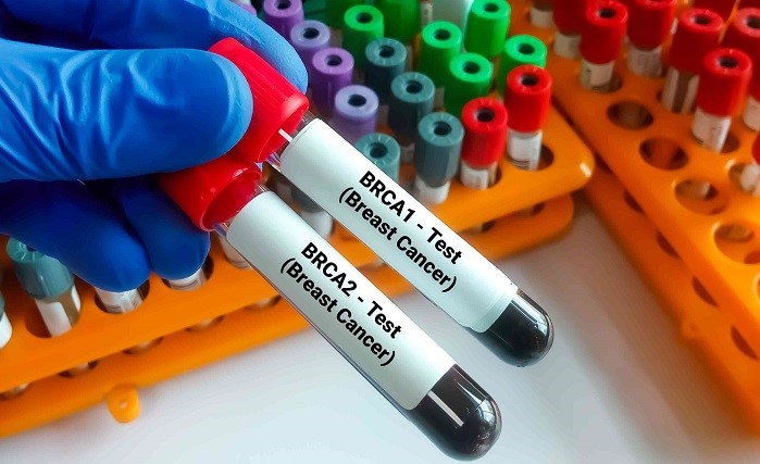 BRCA1 و BRCA2 چه ژن هایی هستند؟